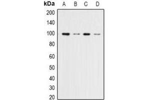 Western blot analysis of ERK3 expression in Hela (A), 293T (B), NIH3T3 (C), rat brain (D) whole cell lysates. (MAPK6 抗体)