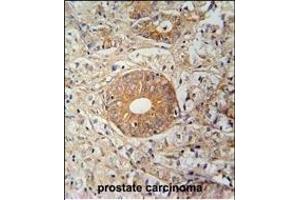 Immunohistochemistry (Paraffin-embedded Sections) (IHC (p)) image for anti-Solute Carrier Family 35, Member E2 (SLC35E2) (AA 1-30), (N-Term) antibody (ABIN654754)