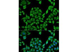 Immunofluorescence analysis of U2OS cells using UGT1A1 Polyclonal Antibody (UGT1A1 抗体)