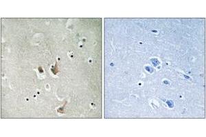 Immunohistochemistry analysis of paraffin-embedded human brain tissue, using CKS2 Antibody. (CKS2 抗体  (AA 1-50))