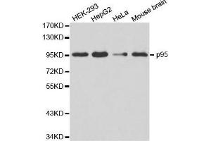 Western blot analysis of extracts of various cell lines, using NBN antibody. (Nibrin 抗体  (AA 435-754))