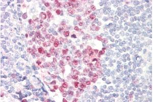 ABIN5539501 (5µg/ml) staining of paraffin embedded Human Tonsil. (Deoxyuridine Triphosphatase (DUT) (Internal Region) 抗体)