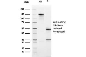 SDS-PAGE Analysis Purified TCF4 Mouse Monoclonal Antibody (PDL1/2741). (PD-L1 抗体  (AA 39-191))