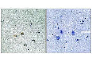 Immunohistochemistry (IHC) image for anti-P21-Activated Kinase 1 (PAK1) (Ser204) antibody (ABIN1848246) (PAK1 抗体  (Ser204))