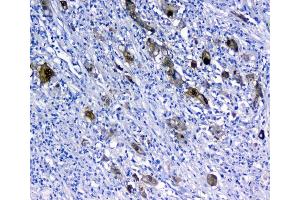 IHC analysis of 14-3-3 sigma using anti-14-3-3 sigma antibody (ABIN5693156).