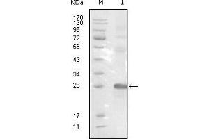 Western blot analysis using EphB3 mouse mAb against truncated EphB3-His recombinant protein. (EPH Receptor B3 抗体  (AA 39-212))