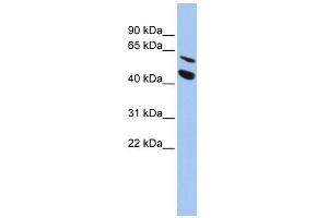 MMP24 antibody used at 1 ug/ml to detect target protein.