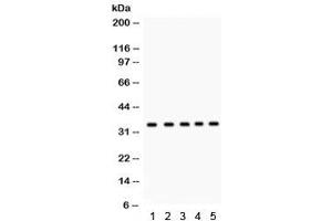 Western blot testing of 1) rat testis, 2) human 22RV1, 3) HeLa, 4) MCF7, and 5) Jurkat lysate with EBAG9 antibody. (RCAS1 抗体  (AA 31-213))