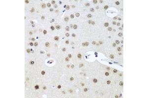 Immunohistochemistry (IHC) image for anti-UTP14, U3 Small Nucleolar Ribonucleoprotein, Homolog A (UTP14A) (AA 1-260) antibody (ABIN6150037)