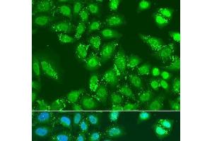 Immunofluorescence analysis of U2OS cells using HDAC4 Polyclonal Antibody at dilution of 1:100. (HDAC4 抗体)