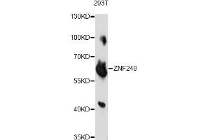 Western blot analysis of extracts of 293T cells, using ZNF248 antibody. (ZNF248 抗体)