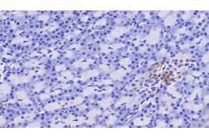 Detection of RBP4 in Human Pancreas Tissue using Polyclonal Antibody to Retinol Binding Protein 4 (RBP4) (RBP4 抗体)