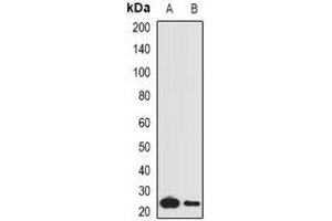 Western blot analysis of Complement C1QA expression in mouse lung (A), mouse liver (B) whole cell lysates. (C1QA 抗体)