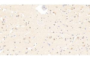 Detection of IL19 in Human Cerebrum Tissue using Monoclonal Antibody to Interleukin 19 (IL19)