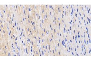 Detection of HIF2a in Human Cardiac Muscle Tissue using Polyclonal Antibody to Hypoxia Inducible Factor 2 Alpha (HIF2a) (EPAS1 抗体  (AA 339-541))