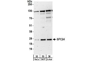 anti-SPC24, NDC80 Kinetochore Complex Component, Homolog (SPC24) (AA 1-50) antibody