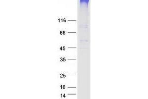 Western Blotting (WB) image for Solute Carrier Family 19, Member 3 (Slc19a3) protein (Myc-DYKDDDDK Tag) (ABIN2732152)