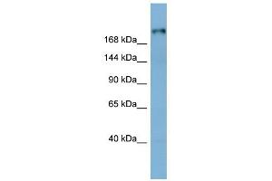 Laminin Beta 1 antibody used at 1 ug/ml to detect target protein. (Laminin beta 1 抗体  (Middle Region))
