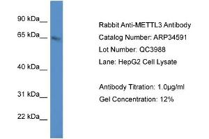 WB Suggested Anti-METTL3 Antibody   Titration: 1. (METTL3 抗体  (C-Term))