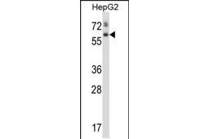 Western blot analysis in HepG2 cell line lysates (35ug/lane). (Asparaginase 抗体  (AA 165-193))