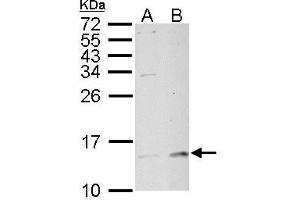 WB Image MP1 antibody detects MP1 protein by Western blot analysis.