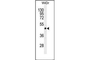Western blot analysis of Gasdermin C Antibody (Center) in WiDr cell line lysates (35ug/lane). (MLZE 抗体  (Middle Region))