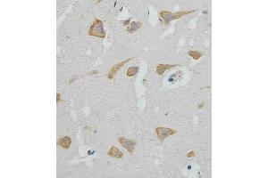 (ABIN388564 and ABIN2849716) staining GABAR in human brain tissue sections by Immunohistochemistry (IHC-P - paraformaldehyde-fixed, paraffin-embedded sections). (GABARAP 抗体  (AA 1-30))