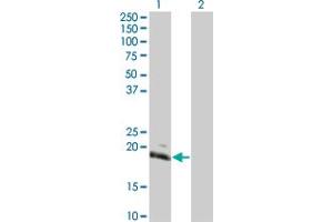 Western Blot analysis of HAND2 expression in transfected 293T cell line by HAND2 monoclonal antibody (M05), clone 4D9.