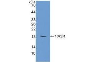 Detection of Recombinant FABP3, Bovine using Polyclonal Antibody to Heart-type Fatty Acid Binding Protein (H-FABP) (FABP3 抗体  (AA 1-133))