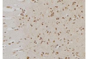 ABIN6276553 at 1/100 staining Human brain tissue by IHC-P. (DUSP6 抗体  (Internal Region))