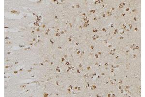 ABIN6276553 at 1/100 staining Human brain tissue by IHC-P. (DUSP6 抗体  (Internal Region))
