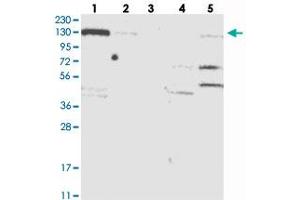 Western blot analysis of Lane 1: RT-4, Lane 2: U-251 MG, Lane 3: Human Plasma, Lane 4: Liver, Lane 5: Tonsil with NCOA7 polyclonal antibody  at 1:250-1:500 dilution. (NCOA7 抗体)