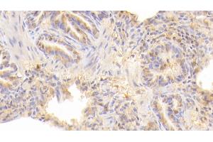 Detection of CD40L in Human Lung Tissue using Polyclonal Antibody to Cluster Of Differentiation 40 Ligand (CD40L)