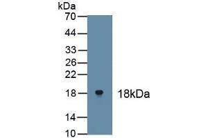 Detection of Recombinant TP63, Human using Polyclonal Antibody to Tumor Protein P63 (TP63) (p63 抗体)