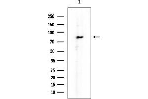 anti-Zinc Finger Protein 226 (ZNF226) antibody
