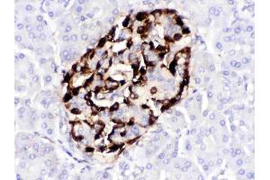 VIP was detected in paraffin-embedded sections of human pancreatic cancer tissues using rabbit anti- VIP Antigen Affinity purified polyclonal antibody (Catalog # ) at 1 ? (Vip 抗体  (Middle Region))