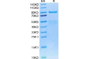 SDS-PAGE (SDS) image for Met Proto-Oncogene (MET) (AA 25-930) protein (His tag) (ABIN7275246)