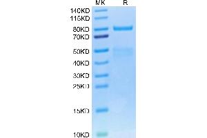 Cynomolgus HGF R on Tris-Bis PAGE under reduced condition. (c-MET Protein (AA 25-930) (His tag))