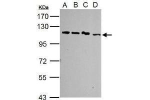 WB Image Sample (30 ug of whole cell lysate) A: Jurkat B: Raji C: K562 D: NCI-H929 7.