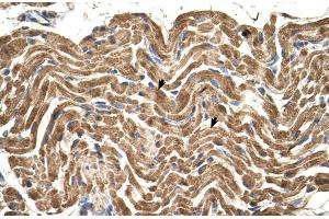 Immunohistochemistry (IHC) image for anti-ATP Synthase, H+ Transporting, Mitochondrial F1 Complex, beta Polypeptide (ATP5B) (N-Term) antibody (ABIN2783268)