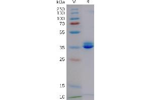 SDS-PAGE (SDS) image for G Protein-Coupled Receptor, Family C, Group 5, Member D (GPRC5D) (AA 1-21) protein (Fc Tag) (ABIN7490647)