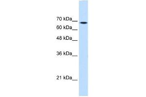 WB Suggested Anti-TGM2 Antibody Titration:  0. (Transglutaminase 2 抗体  (Middle Region))