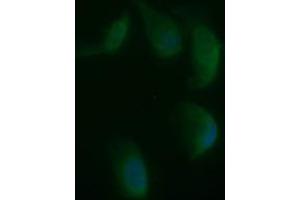 Image no. 2 for anti-Synaptophysin (SYP) antibody (ABIN1501259) (Synaptophysin 抗体)