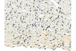 Phospho-TMS1/ASC (Ser195) Antibody at 1/100 staining Rat heart tissue by IHC-P. (PYCARD 抗体  (pSer195))