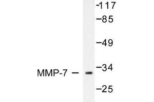Image no. 1 for anti-Matrix Metallopeptidase 7 (Matrilysin, Uterine) (MMP7) antibody (ABIN265532) (MMP7 抗体)