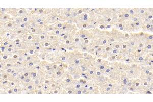 Immunohistochemistry (IHC) image for anti-Superoxide Dismutase 1, Soluble (SOD1) (AA 2-153) antibody (APC) (ABIN7436933)