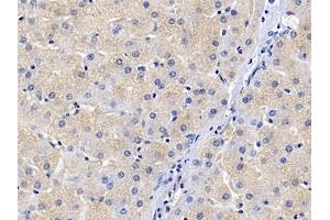 Detection of SLC in Human Liver Tissue using Polyclonal Antibody to Secondary Lymphoid Tissue Chemokine (SLC) (CCL21 抗体  (AA 24-134))