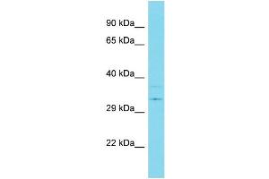 Host:  Rabbit  Target Name:  USP39  Sample Type:  Breast Tumor lysates  Antibody Dilution:  1. (USP39 抗体  (C-Term))