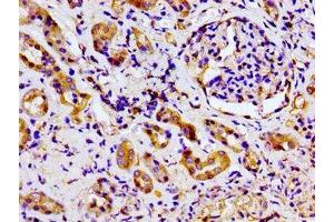 Immunohistochemistry of paraffin-embedded human kidney tissue using ABIN7169068 at dilution of 1:100 (MARK2 抗体  (AA 373-594))