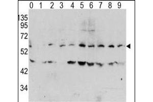 Western blot analysis of Phospho-MYC-T58 Antibody in human T activated Hela cell line lysates. (c-MYC 抗体  (pThr58))
